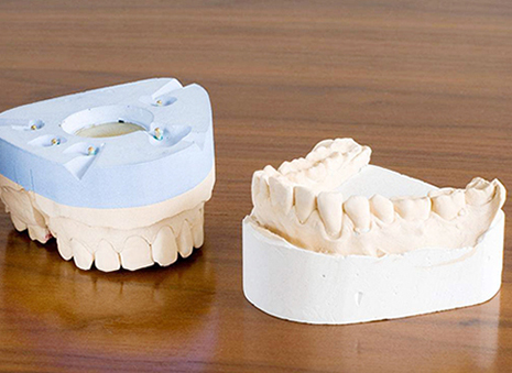 牙齿模具